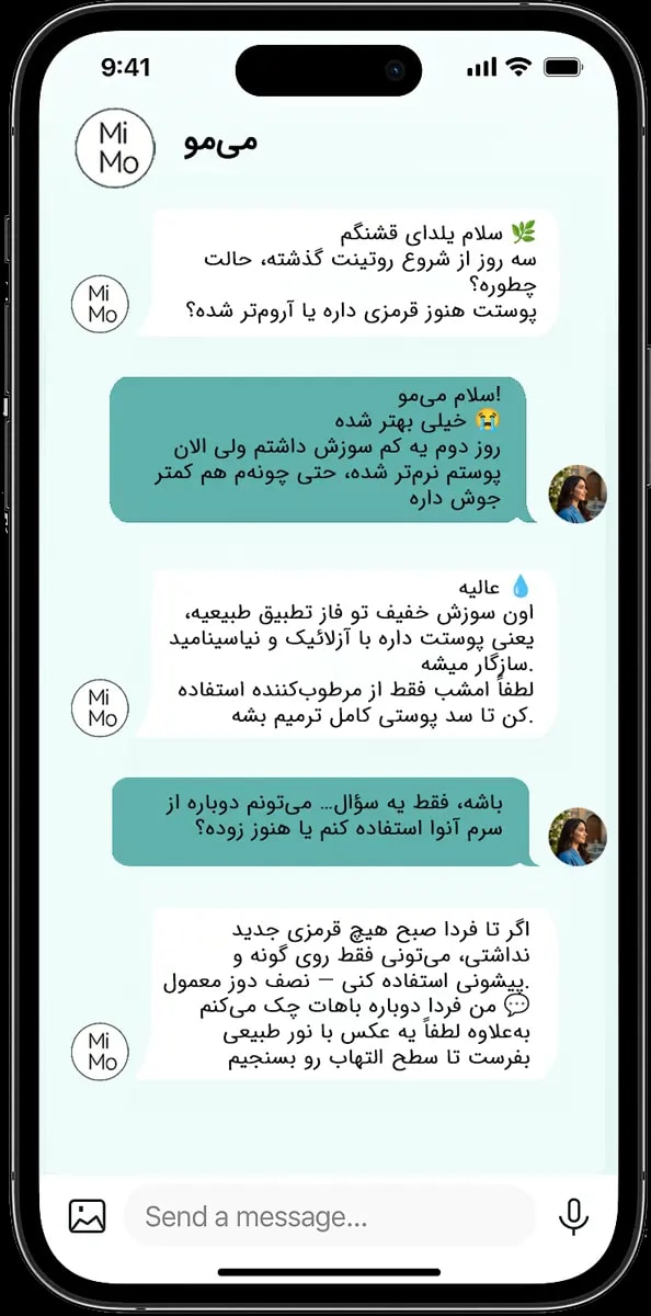 مشاوره هوشمند با میمو